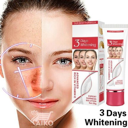 کرم سفید کننده صورت و بدن تیوپی 3 روزه شینگ کیمی